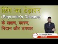 लिंग का टेढ़ापन (Peyronie's Disease) के लक्षण, कारण, निदान और उपचार | Dr. Vinayak Abbot | Lybrate