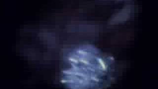 Watch Head Of Femur Manhattan video