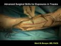 Two Incision Four Compartment Fasciotomy