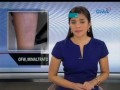 SAKSI: OFW sa Saudi, ilang beses daw pinlantsa ng kanyang amo