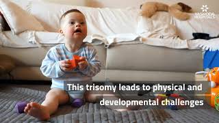 Down Syndrome Explained In A Minute Child With Down Syndrome