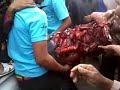 image Tragedi Nambo Petasan Jumbo Saat Dibawa Ke Rs