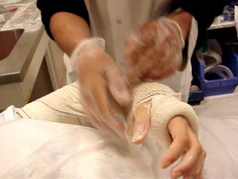 Les lampes ultraviolettes du psoriasis