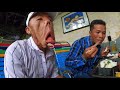 Chàng trai mặt quỷ gặp bác sĩ để lấy lại khuôn mặt | Phong Bụi