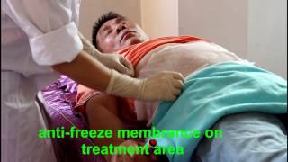 Watch Cryo Machine video