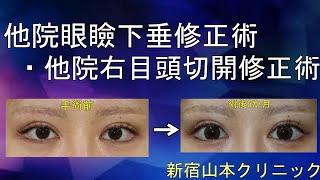 手術は何度もできるものではありません!! 山本クリニック