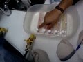 LAB. Microbiologia Clinica. Ureaplasma y Mycoplasma. Resultados