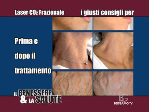 Sogno sulla persona in posti