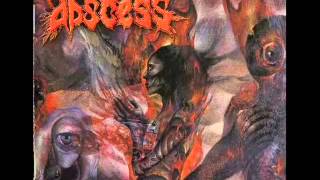 Watch Abscess An Asylum Below video