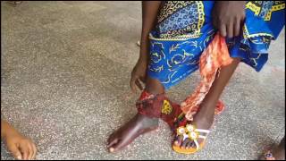 AVEUX "Pour obtenir des pouvoirs mystiques des sorcières vendent leurs pieds"
