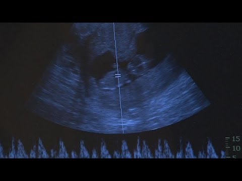 Kürtaj Konusu Bu Kez İspanya'yı Böldü - Reporter
