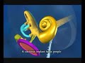 Cochlear Implant Introduction