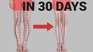 30 Günde Düz ve Uzun Bacaklara sahip Olun! İçe Dönük Diz (Eğri bacaklar) Sorunun
