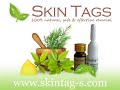 tags
