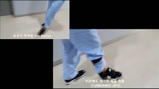 비골신경마비 족하수 환자의 재활을 돕는 터보메드 보조기 (TURBOMED AFO for peroneal nerve palsy patient)