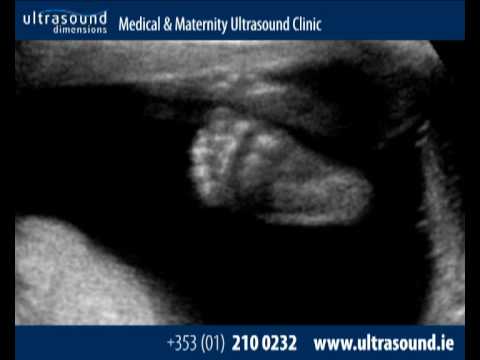 3d ultrasound scan. pregnancy ultrasound scan