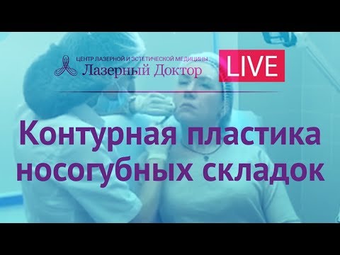 Контурная пластика носогубных складок - трансляция в Periscope Контурная пластика носогубных складок - трансляция в Periscope