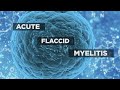 Understand: Acute flaccid myelitis and its symptoms
