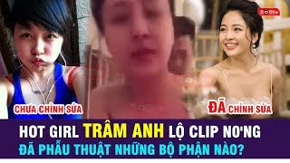 NÓNG: HOT GIRL TRÂM ANH LỘ CLIP N0'NG VÀ ĐÃ PHẪU THUẬT NHỮNG BỘ PHẬN NÀO?