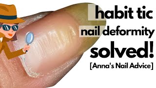 Uneven ridgy thumbnails |  Habit Tic Nail Deformity SOLVED!