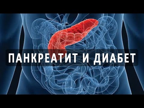 Панкреатит и диабет связаны Панкреатит и диабет связаны