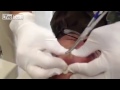 zit
