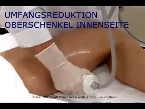 fettabbau durch ultraschall erfahrungsberichte