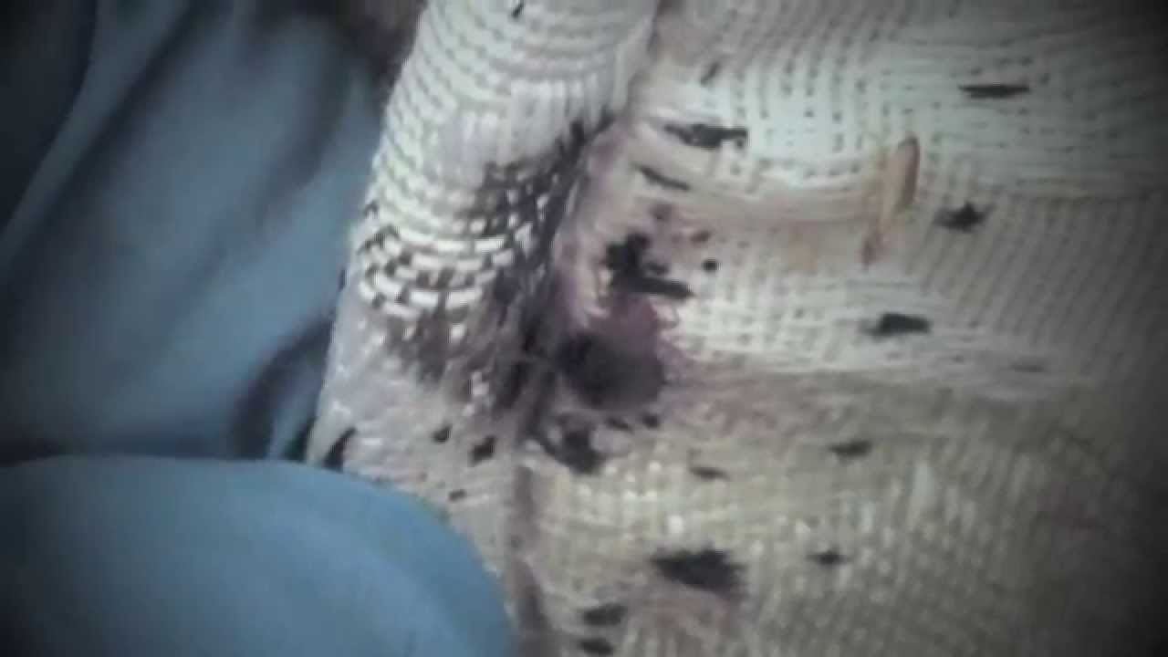 ... Live Examples of What Bed Bugs Look Like to the Human Eye - YouTube