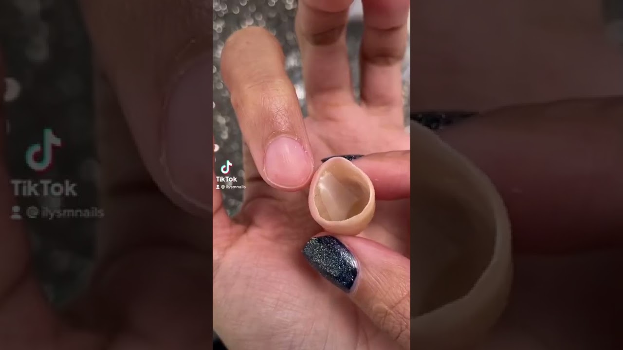 Prosthetic Finger Application & Removal @amputee.barbie Prosthetic Finger Application & Removal @amputee.barbie