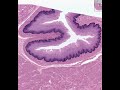 Title:Shotgun Histology Esophagus Description:Shotgun Histology Esophagus
