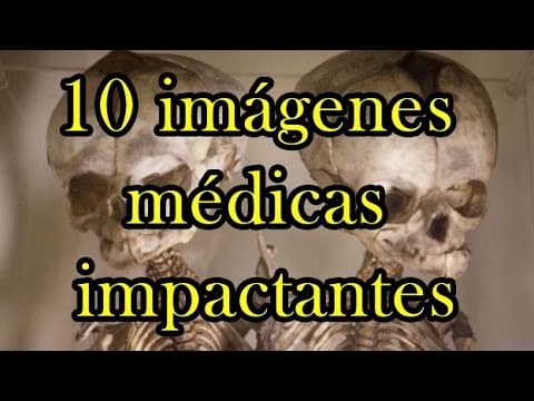 Imagenes Medicas Impactantes | hqdefault jpg Imagenes Medicas Impactantes | hqdefault jpg