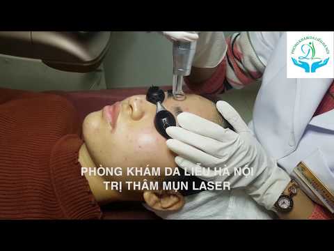 Trị Thâm Mụn Công Nghệ Laser NanoTech
