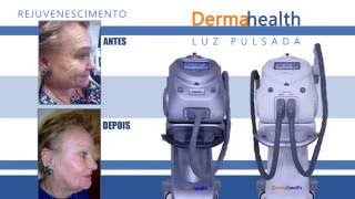 Luz Intensa Pulsada + Criofrequência Dermahealth