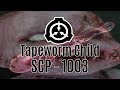 "Tapeworm Child" SCP-1003