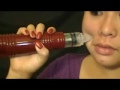 Acne suction is needed to control scar.wmv