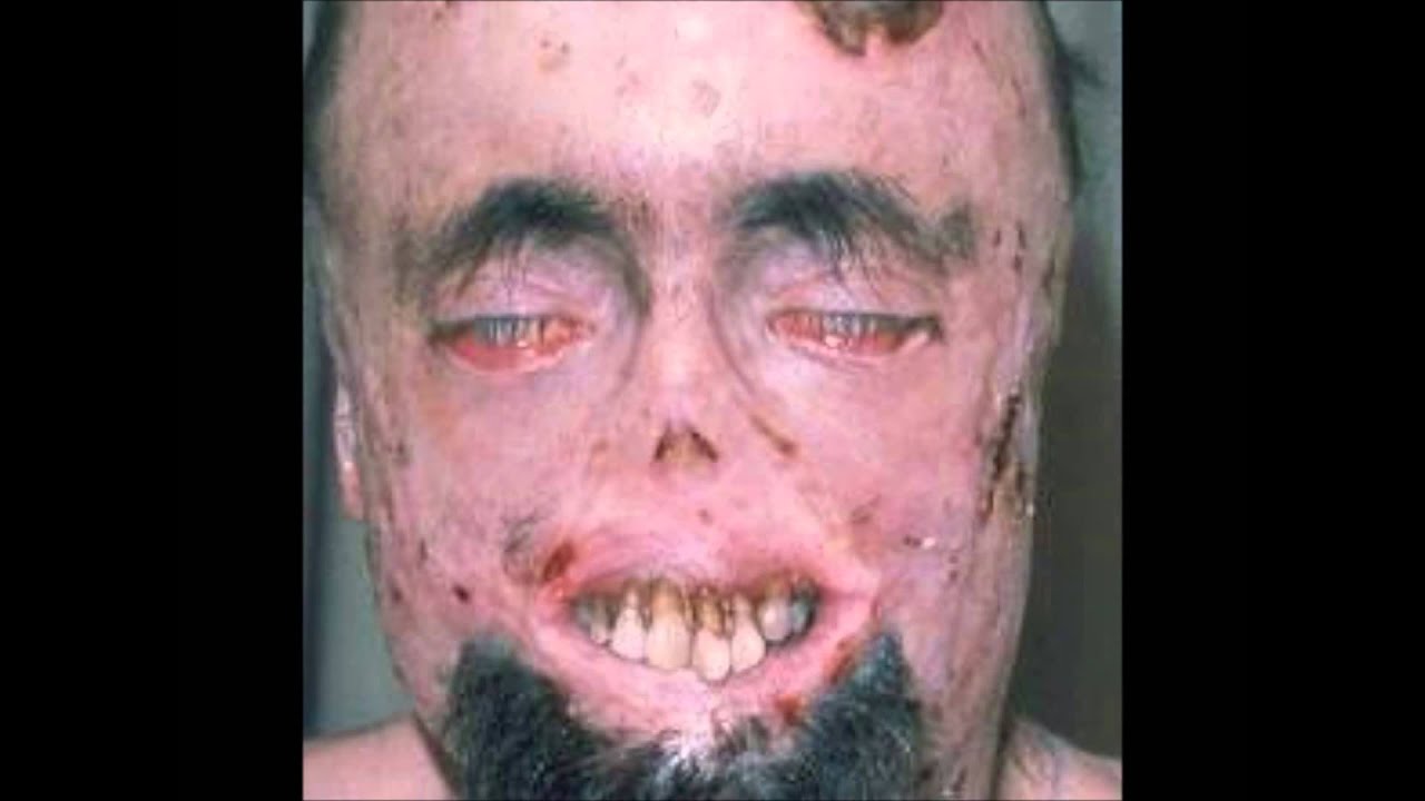 Imagenes Raras Y Feas | las personas mas feas i raras del mundo parte 2 youtube Imagenes Raras Y Feas | las personas mas feas i raras del mundo parte 2 youtube