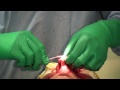 surgery