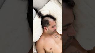 They Shaved His Head