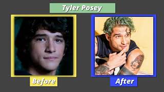 Teen Wolf Oyuncuları Önceki Ve Sonraki Halleri Teen Wolf Players Before After