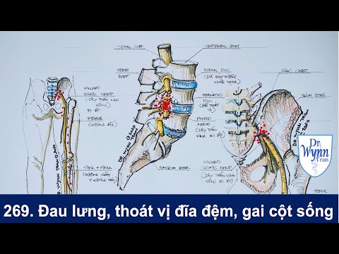 #269. Bệnh đau lưng, thoát vị đĩa đệm, và gai cột sống