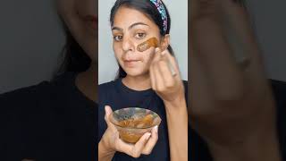 I Use Divya Kanti Lep 7 Days Remove Pimples