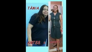 Tânia - Miastenia Gravis (parte 2)