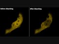 Silicon Nanowires In Blood for Imaging