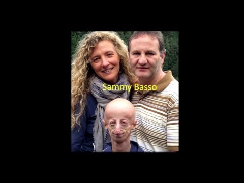 Come trasformare la disabilità in forza produttiva! | Sammy Basso | TEDxLecce