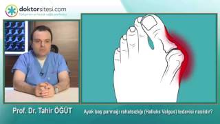 Ayak baş parmağı rahatsızlığı (Halluks Valgus) tedavisi nasıldır?