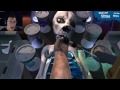 surgery