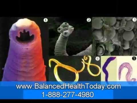 Parasito Intestinal Candida Diet