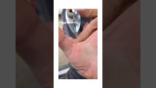 Pulled A Toothpick Out Of A Mans Hand