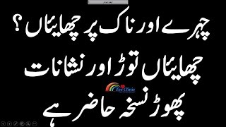 Nak Or Chehray K Nishaanat K Liay Zabrdast Nuskha ناک اور چہرے پر چھایئوں کے نشانات کا نسخہ