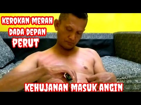 KEROKAN MERAH MERONA DADA DEPAN DAN PERUT.